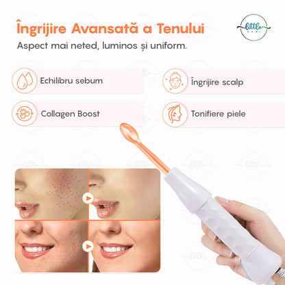 Electroderm, LittleDomi, Tratament cu Frecventa Inalta pentru Acnee, Riduri, Controlul Petelor, Cearcane, Ten, Par Seboreic, Stimulator Scalp, Infrumusetare, Biostimulare Faciala, Lifting, Alb — LD-329 fotografie 3