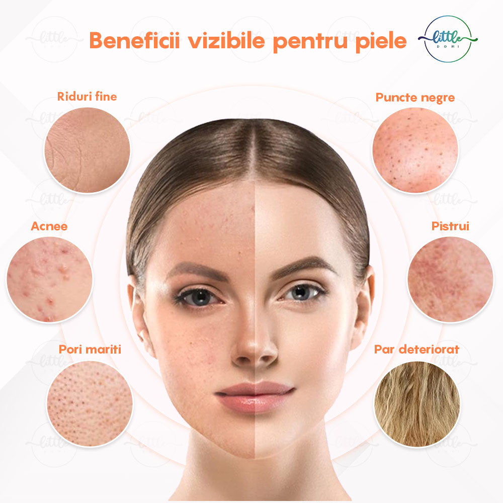 Electroderm, LittleDomi, Tratament cu Frecventa Inalta pentru Acnee, Riduri, Controlul Petelor, Cearcane, Ten, Par Seboreic, Stimulator Scalp, Infrumusetare, Biostimulare Faciala, Lifting, Alb — LD-329 fotografie 6