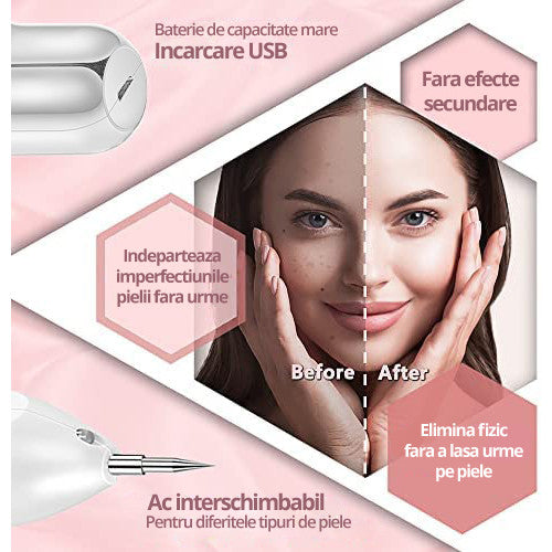 Aparat Plasma Pen LittleDomi, Indepartare Petelor, Negilor, Pistruilor, Cicatricelor, Alunitelor, Tatuajelor, Lifting Pleoape, Ecran LCD, 9 Trepte, Portabil, Reincarcabil, Lampa, 1x Cub Gheata Inox, 2x Servetel cu Alcool, 10x Betisoare, Alb — LD-396 fotografie 4