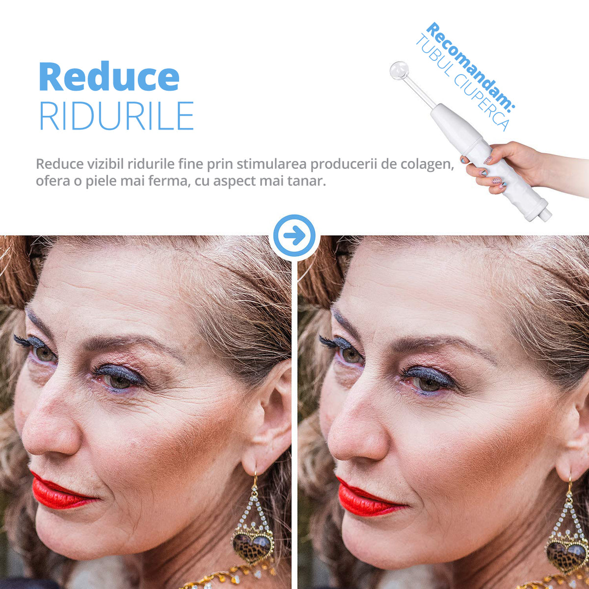 Electroderm, LittleDomi, Tratament cu Neon si Argon pentru Acnee, Riduri, Controlul Petelor, Cearcane, Ten, Par Seboreic, Stimulator Scalp, Infrumusetare, Biostimulare Faciala, Lifting — LD-426 fotografie 7