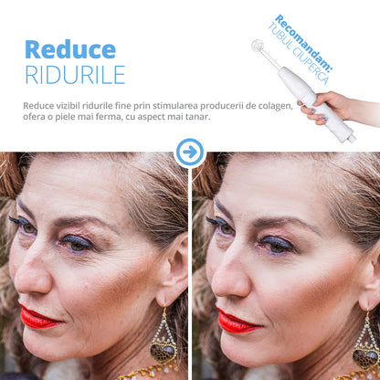 Electroderm, LittleDomi, Tratament cu Neon si Argon pentru Acnee, Riduri, Controlul Petelor, Cearcane, Ten, Par Seboreic, Stimulator Scalp, Infrumusetare, Biostimulare Faciala, Lifting — LD-426 fotografie 7