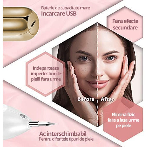 Aparat Plasma Pen LittleDomi, Indepartare Petelor, Negilor, Pistruilor, Cicatricelor, Alunitelor, Tatuajelor, Lifting, Ecran LCD, 9 Trepte, Portabil, Reincarcabil, Lampa, 1x Cub Gheata Inox, 2x Servetel cu Alcool, 10x Betisoare, Auriu/Alb — LD-395 galerie 3